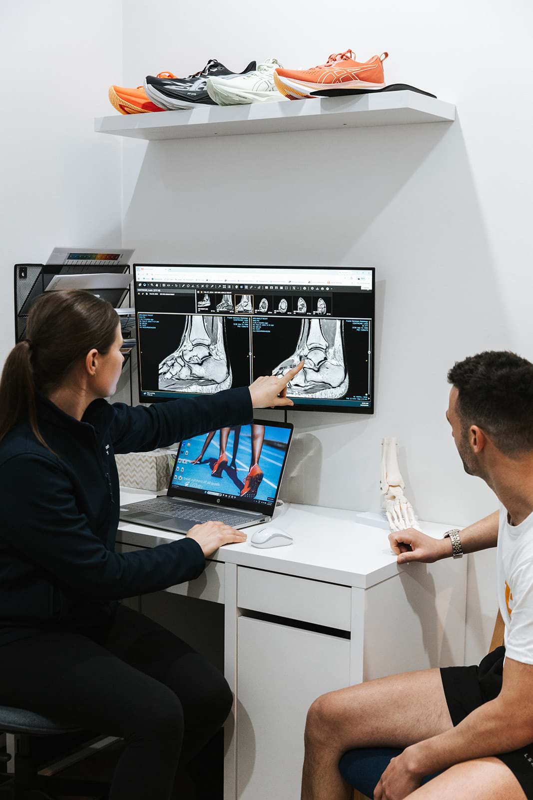 Orthotics as a Key Treatment Modality for Lisfranc Injuries – Pre and Post-Surgery