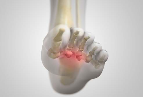 What is it and how can it be treated?